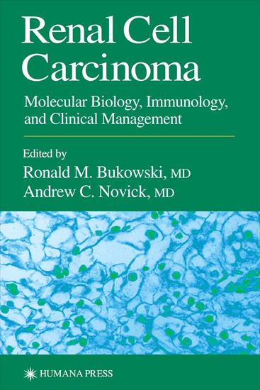 st. Biotechnologia podręczniki - Renal Cell Carcinoma.JPG