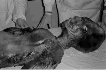 ufo - yugoslav autopsy 66.jpg